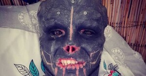 “Alien negro” sorprende con nueva cirugía para transformar su cuerpo: se cortó dos dedos de cada mano - C9N