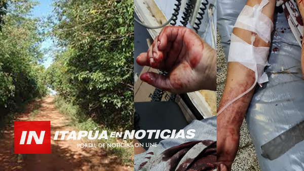 ENCUENTRO EN “TAPE PO´I” TERMINA CON DOS HERIDOS POR ARMA BLANCA EN SAN PEDRO DEL PNÁ. - Itapúa Noticias