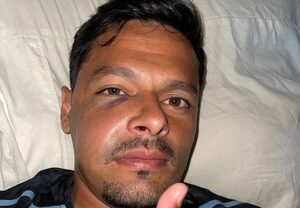 La terrible patada y la grave lesión que sufrió Jorge Salinas