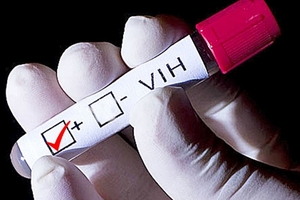 En lo que va del año, fueron registrados más de 860 casos de VIH