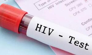 Tres personas por día son diagnosticadas con VIH en Paraguay – Prensa 5