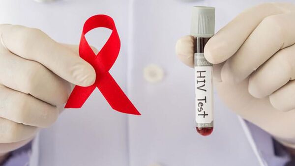 Franja de población joven es la más afectada por VIH en nuestro país