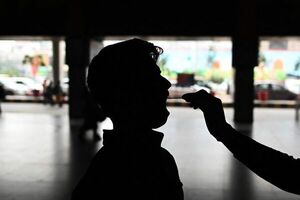 Los pacientes covid con otras patologías desarrollan más anticuerpos - Ciencia - ABC Color