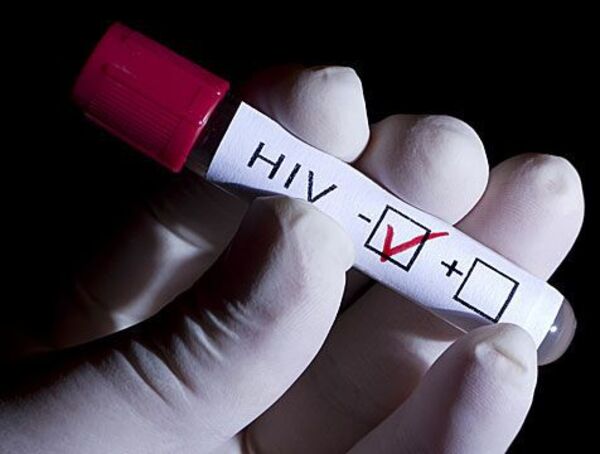 Día Mundial de Lucha contra el VIH: discriminación sigue vigente entre las personas - Nacionales - ABC Color
