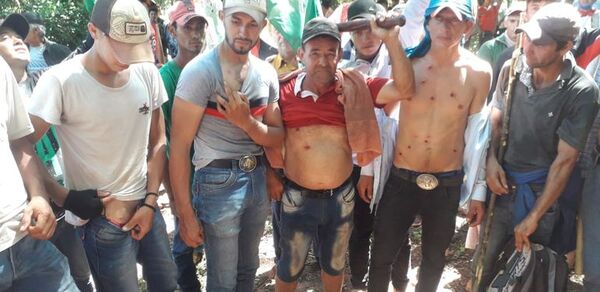 Incidentes entre policías y campesinos desalojados en San Vicente Pancholo - Nacionales - ABC Color