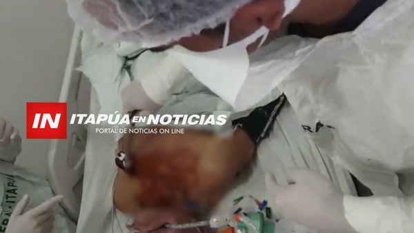 PRIMERA TRAQUEOSTOMIA PERCUTÁNEA EN FRAM, MENOS INVASIVA PARA EL PACIENTE. - Itapúa Noticias