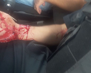 Dos heridos arroja un enfrentamiento armado entre policías y «motochorros» - Noticde.com