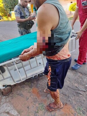Ataque a camión militar en Yby Yaú deja un trabajador de estancia herido - ADN Digital