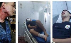 Policías fueron heridos por hinchas de Cerro durante festejos – Prensa 5
