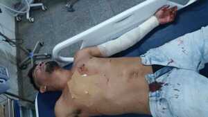 Riña entre indigentes deja un herido en zona de la Terminal de Ómnibus de Encarnación.