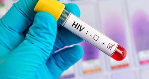 Diario HOY | La lucha contra el VIH en África, ralentizada por el covid-19