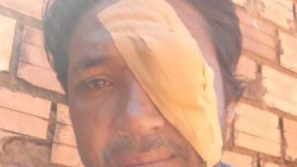 Exjugador de la Albirroja podría perder la vista
