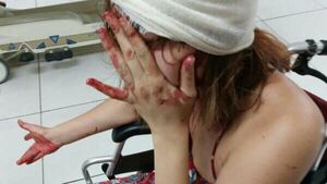 Acusó a su tía de molerla a golpes y querer dejarla en la calle