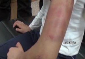 Presunto caso de feminicidio en Peguajó – Itá - SNT