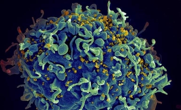 Diario HOY | Vacuna experimental contra el VIH resulta prometedora en animales