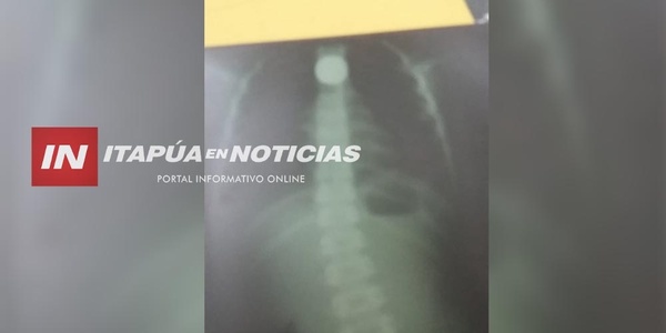 NIÑA DE 5 AÑOS TRAGÓ MONEDA DE MIL Y ESTÁ INTERNADA. SU MAMÁ PIDE AYUDA - Itapúa Noticias