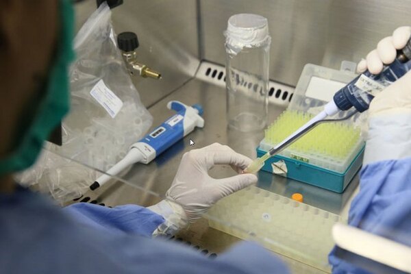 Descubren que pH vaginal bajo podría promover transmisión del Zika de hombre a mujer - .::Agencia IP::.