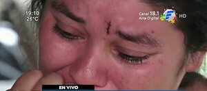 Mujer víctima de violencia teme por su vida ante desamparo de autoridades | Noticias Paraguay