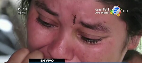 Mujer víctima de violencia teme por su vida ante desamparo de autoridades | Noticias Paraguay