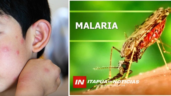 DESDE VIGILANCIA SANITARIA ACCIONAN PARA DETECTAR A TIEMPO CASOS DE MALARIA EN VIAJEROS. - Itapúa Noticias