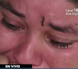Mujer agredida pide auxilio ante desidia de las autoridades - Paraguay.com