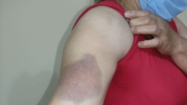 Imputado por moler a golpes e intentar abusa de su exesposa