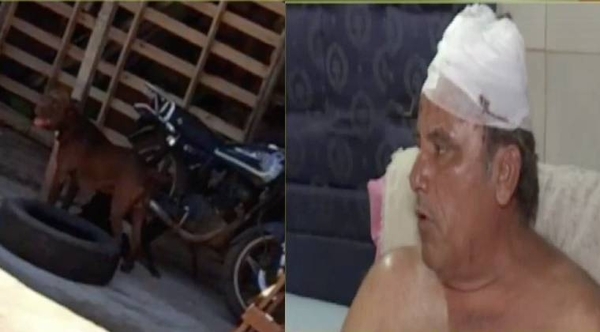 Diario HOY | Hombre zafa de mortal ataque de Pitbull tras arriesgada maniobra