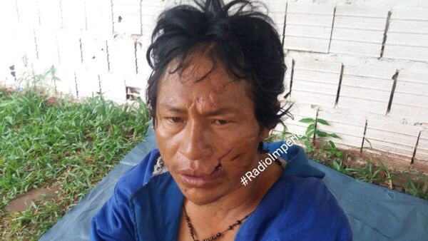 En ronda de tragos indígena fue herido de dos estocadas en el barrio San Blas