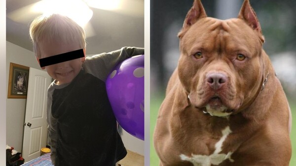 Niño de cuatro años perdió el brazo tras brutal ataque cuando intentó acariciar a un pitbull