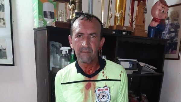 Perdió su club y le reventó la cabeza con su guampa a árbitro