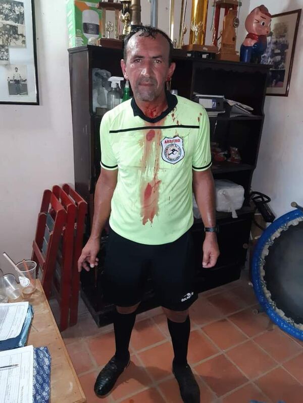 Agreden a arbitro en Tobatí - Fútbol - ABC Color