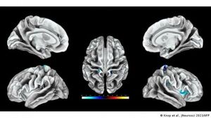 Científicos mapean por primera vez regiones del cerebro que corresponden al clítoris