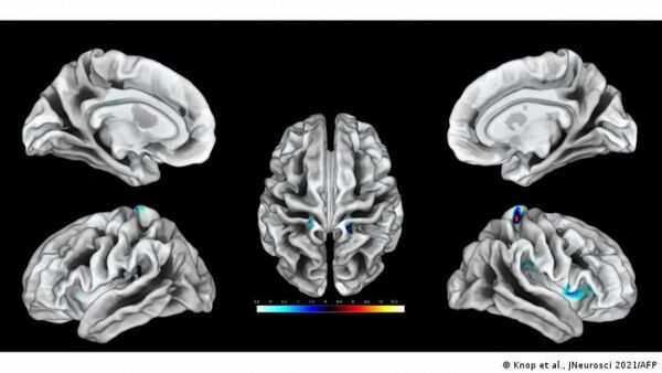 Científicos mapean por primera vez regiones del cerebro que corresponden al clítoris
