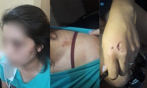 Suman dos casos de violencia contra la mujer, una de ellas quedó desfigurada - OviedoPress