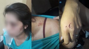 ¡Terrible! Dos casos de violencia contra la mujer en Mariano Roque Alonso