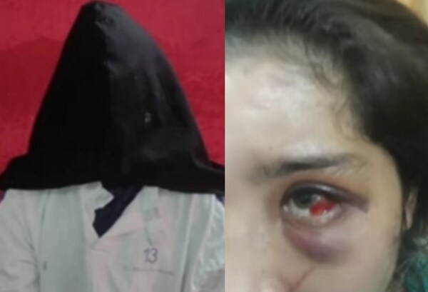 Hombre le desfiguró el rostro a su pareja por celos - Noticiero Paraguay