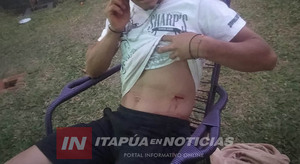 SE METIÓ EN UNA PELEA Y TERMINÓ HERIDO CON UN CUCHILLAZO - Itapúa Noticias