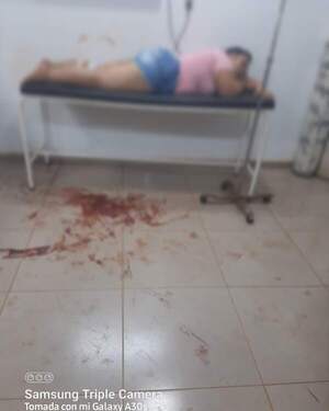 Desconocidos balean a una mujer en Oleary - La Clave