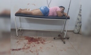Mujer es baleada en intento de asalto en O´leary
