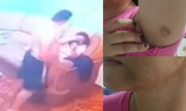 Detienen a policía que golpeó brutalmente a su pareja en Coronel Oviedo – Prensa 5