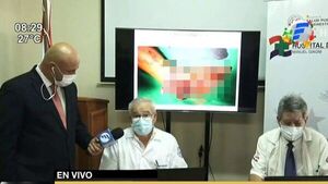 "El cebollón es como echarte tres heladeras sobre el dedo"