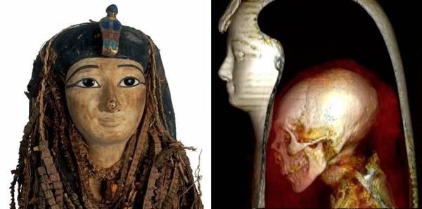 Diario HOY | Tomografía computarizada revela los secretos de la momia de Amenhotep I