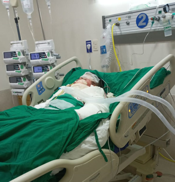 Joven que habría sido quemado por su pareja sigue grave en Asunción | DIARIO PRIMERA PLANA