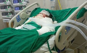 Derramó combustible y prendió fuego a su novio aparentemente por celos