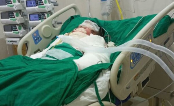 Derramó combustible y prendió fuego a su novio aparentemente por celos