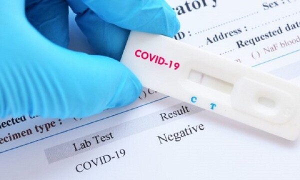 COVID 19: Se triplicaron llamadas al 154 - C9N