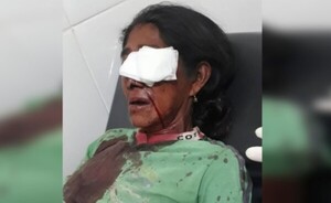 Nativa es herida de un disparo en el rostro