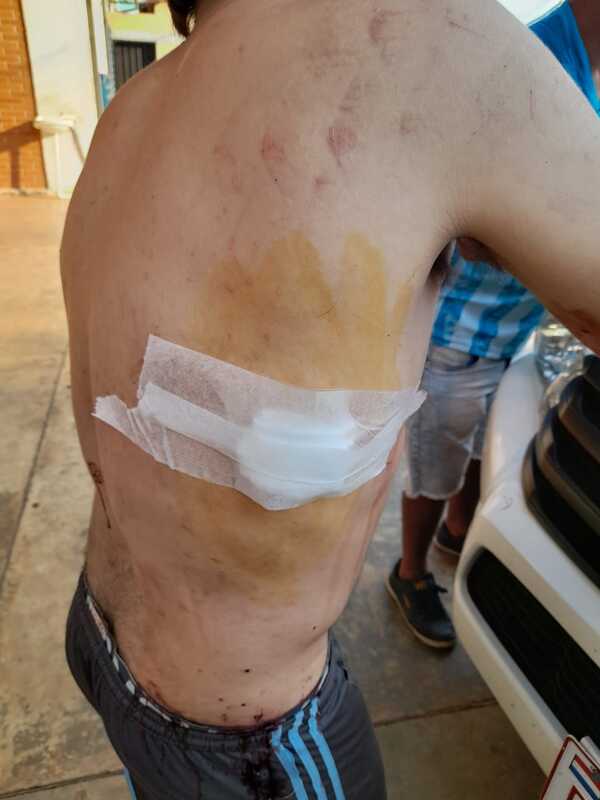 Riña en estación de servicios dejó un herido por arma blanca en Coronel Bogado