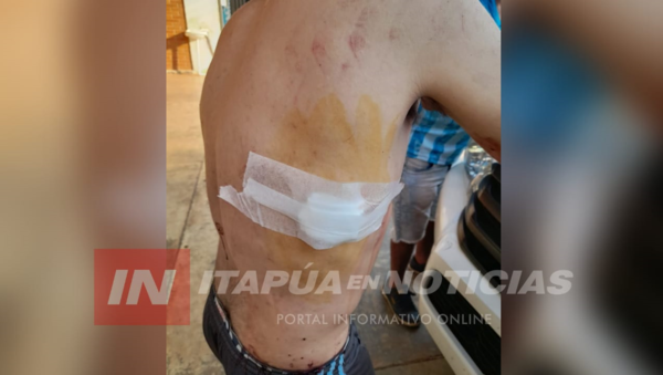 HERIDO DE ARMA BLANCA EN CNEL. BOGADO - Itapúa Noticias