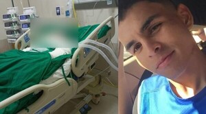 Joven sufre graves quemaduras: sospechan de su novia